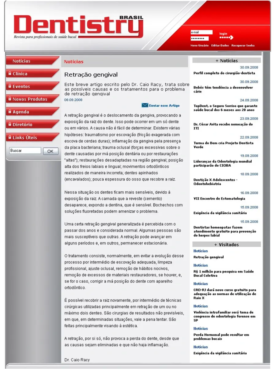 Dr. Caio Racy em artigo publicado na Revista Dentistry Brasil sobre retração gengival.